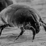 dust mites